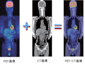 ２つの検査を融合させた
PET-CT検査とは？