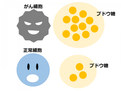 どうやってがんを見つける？
検査のメカニズムを解説